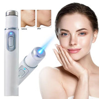 Thumbnail for Acne Laser Removal Pen with Blue Light
